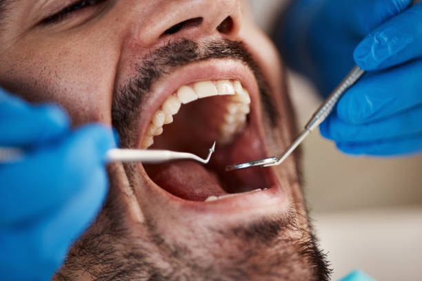Best Emergency Treatment for Dental Infections or Abscesses in Ravenna, OH